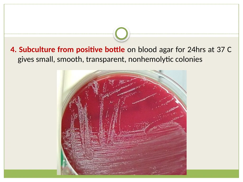 Brucellosis Introduction Brucella is an obligate - slide 16 of 29