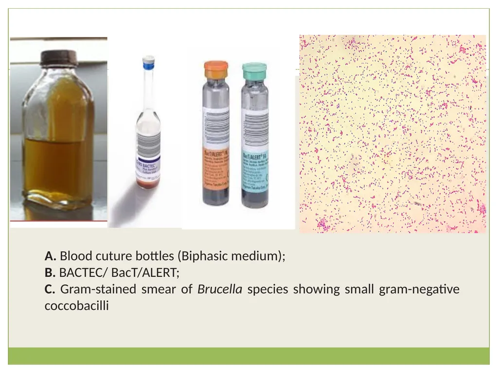 Brucellosis Introduction Brucella is an obligate - slide 15 of 29