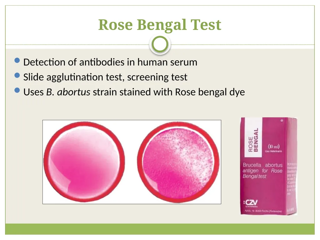 Brucellosis Introduction Brucella is an obligate - slide 19 of 29