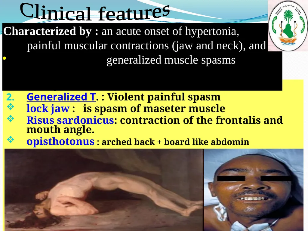 Learning objectives of Brucellosis lectures : - slide 15 of 21