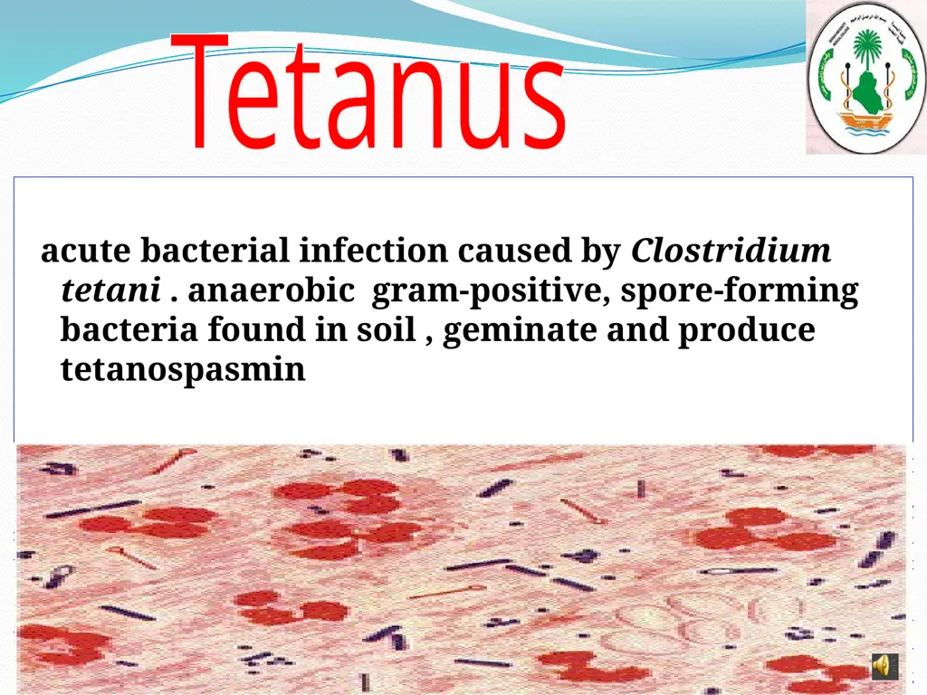 Learning objectives of Brucellosis lectures : - slide 14 of 21