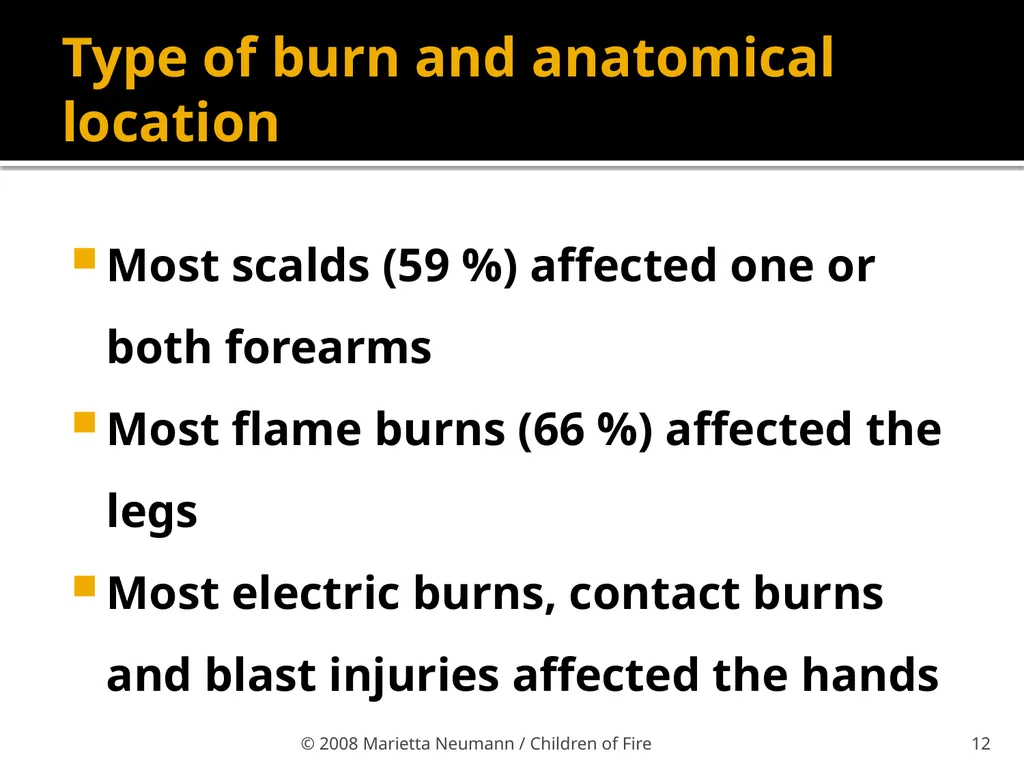 Burn injuries in children Statistics Record - slide 9 of 18