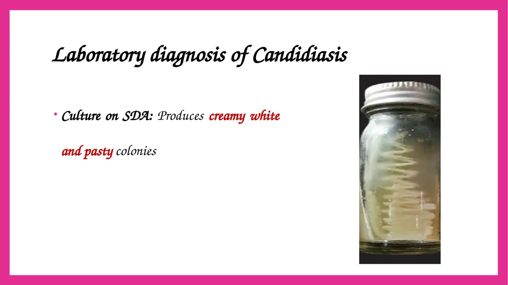 SYSTEMIC CANDIDIASIS Dr. Priyanka Chaturvedi - slide 14 of 28