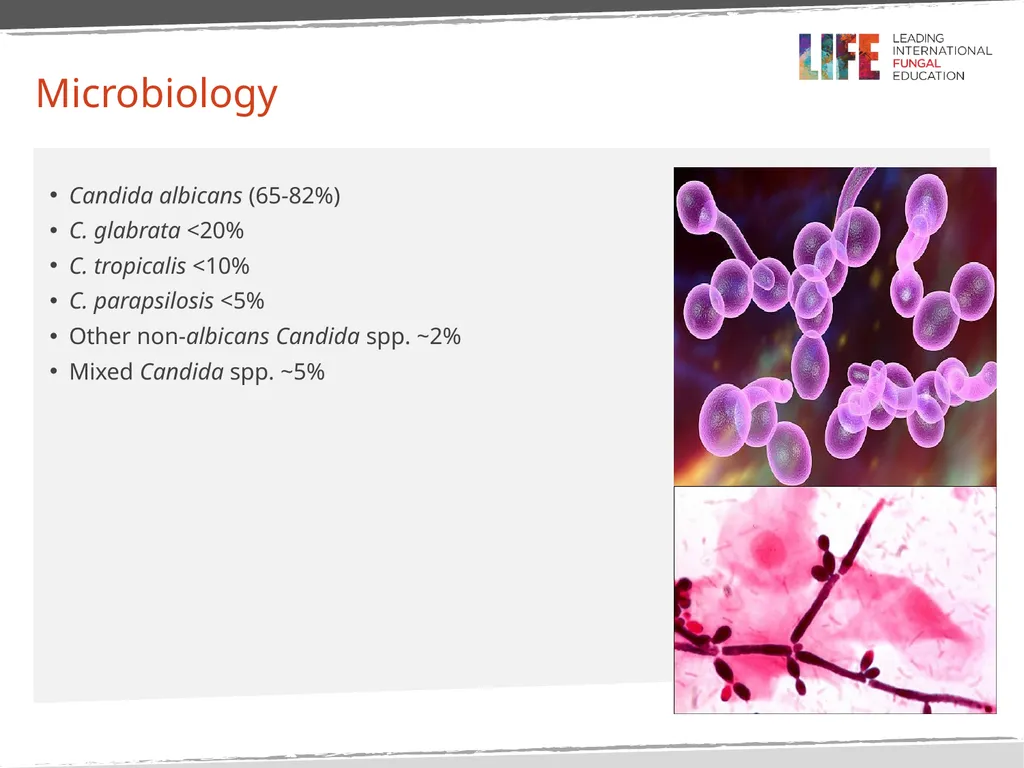 Intra-Abdominal Candidiasis, Candida peritonitis - slide 7 of 15