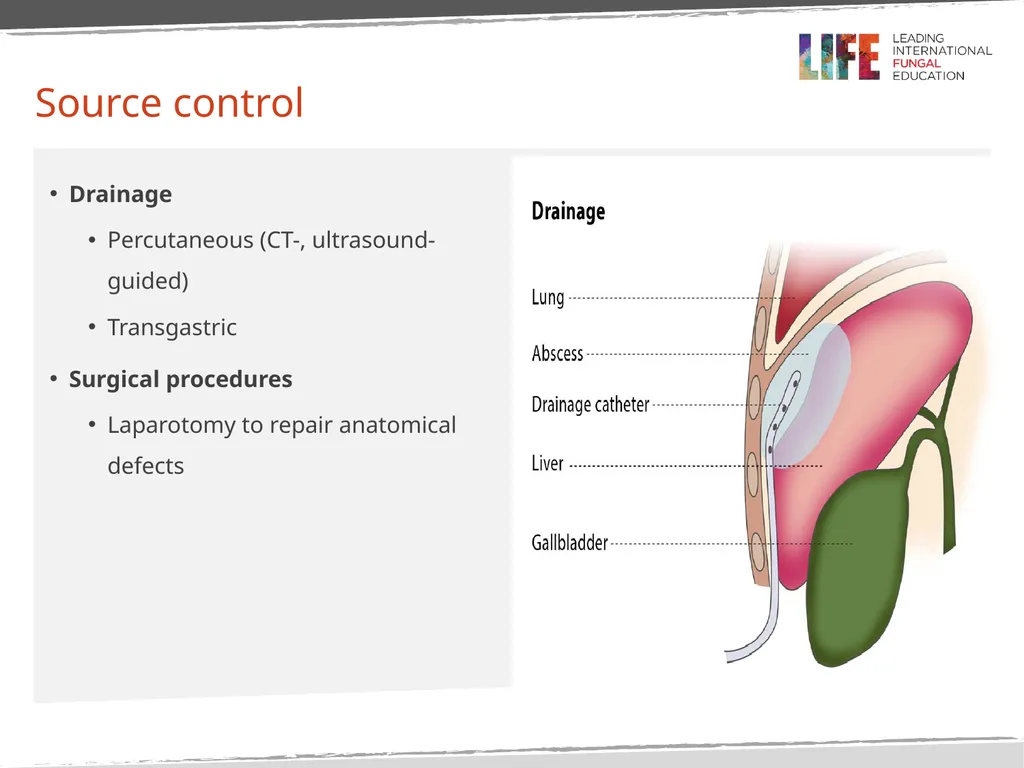 Intra-Abdominal Candidiasis, Candida peritonitis - slide 11 of 15