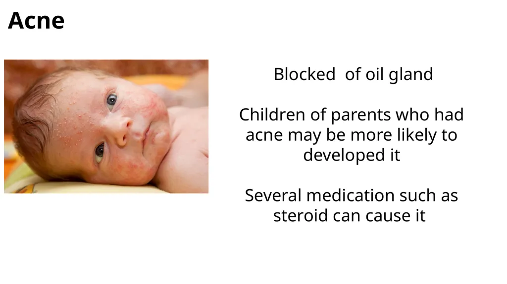 Common dermatological disorders in pediatrics - slide 26 of 35
