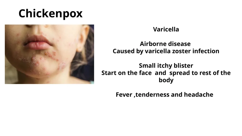 Common dermatological disorders in pediatrics - slide 23 of 35