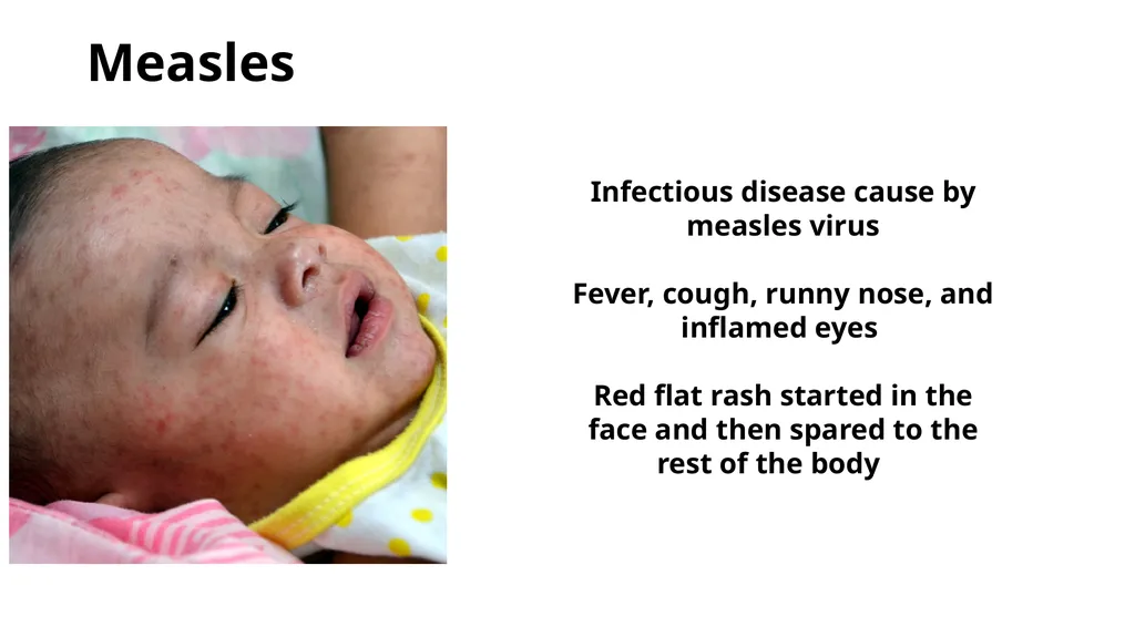 Common dermatological disorders in pediatrics - slide 24 of 35