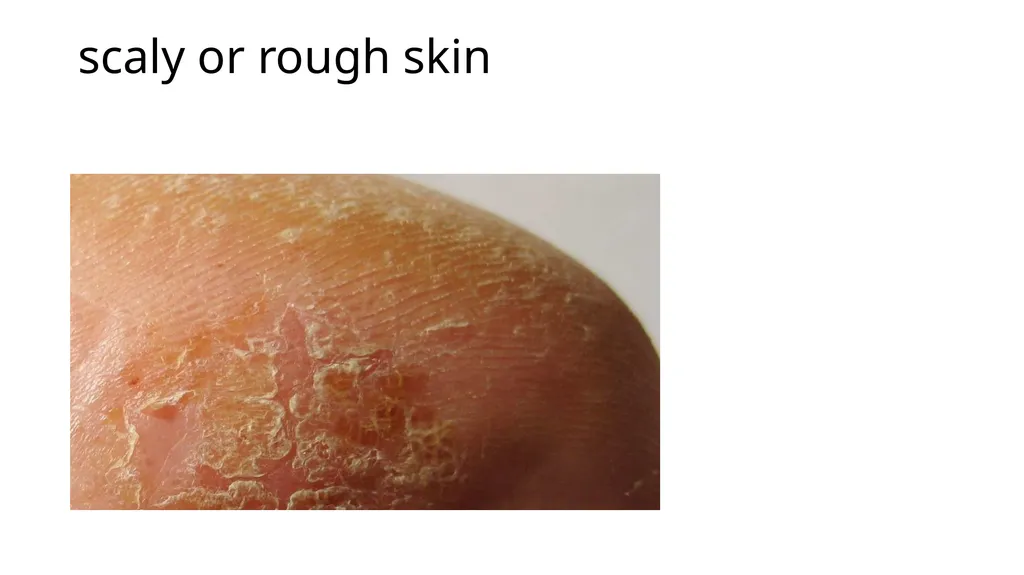 Common dermatological disorders in pediatrics - slide 10 of 35
