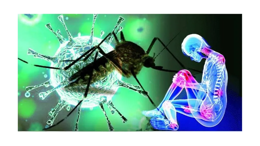 Chikungunya aedes mosquito Alpha virus Rash on - slide 5 of 8