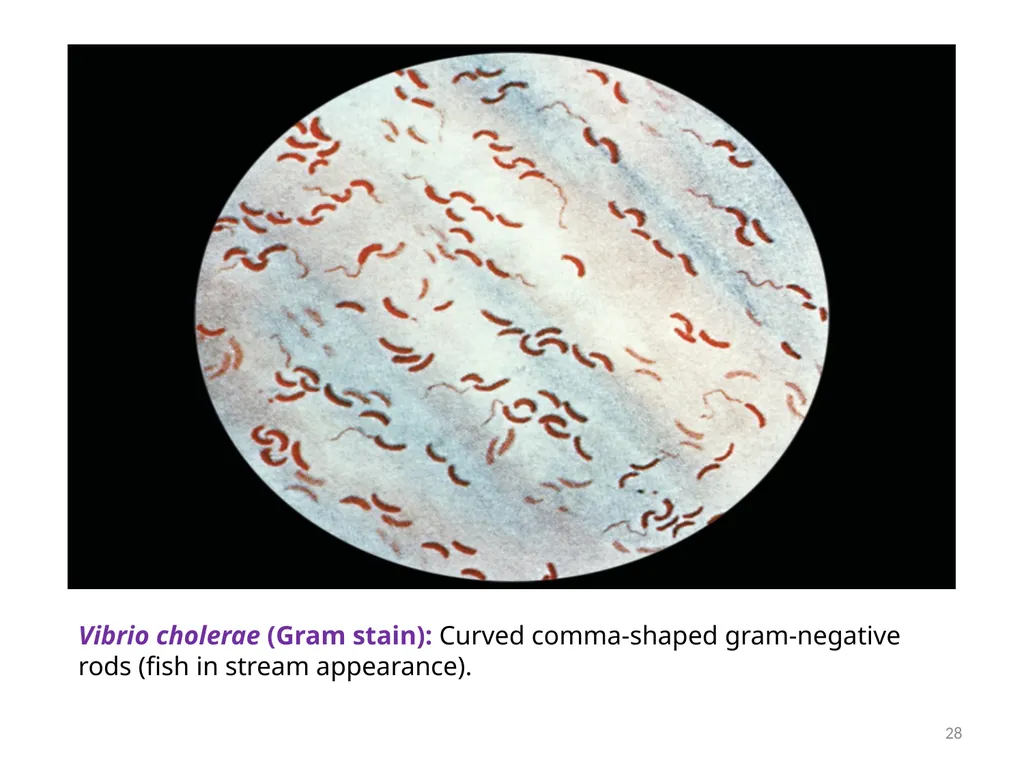 Cholera, Halophilic Vibrio and Aeromonas - slide 28 of 61