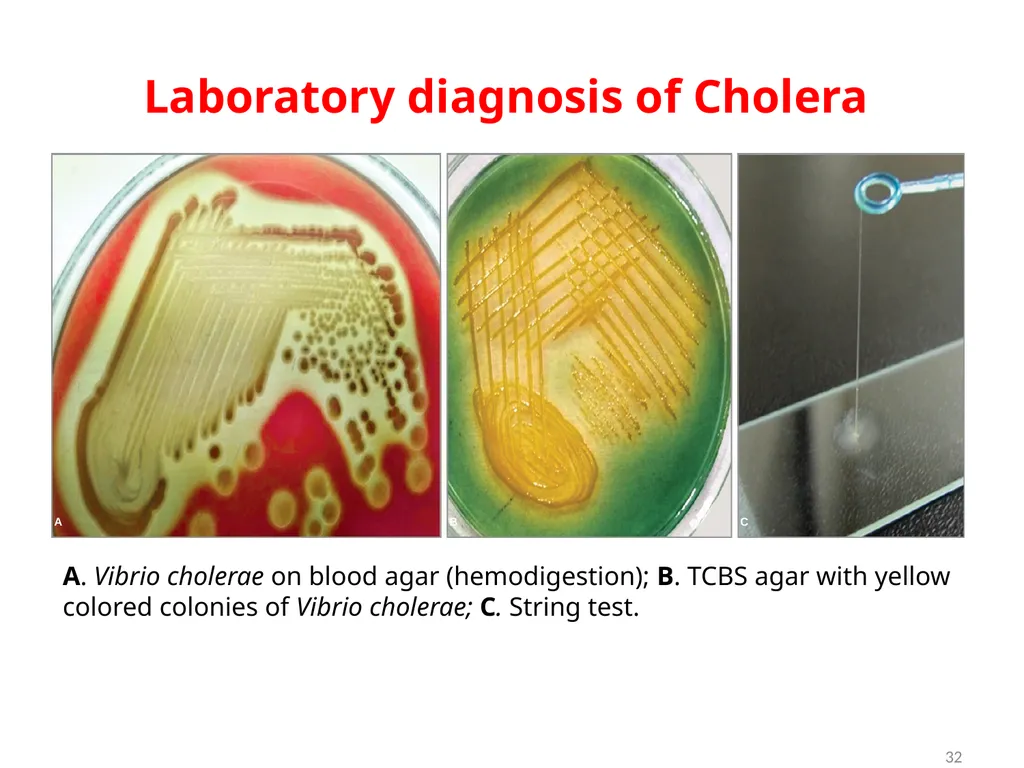 Cholera, Halophilic Vibrio and Aeromonas - slide 32 of 61