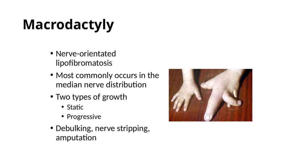 Congenital Hand Abnormalities Nick Sheppard AO AF - slide 3 of 26