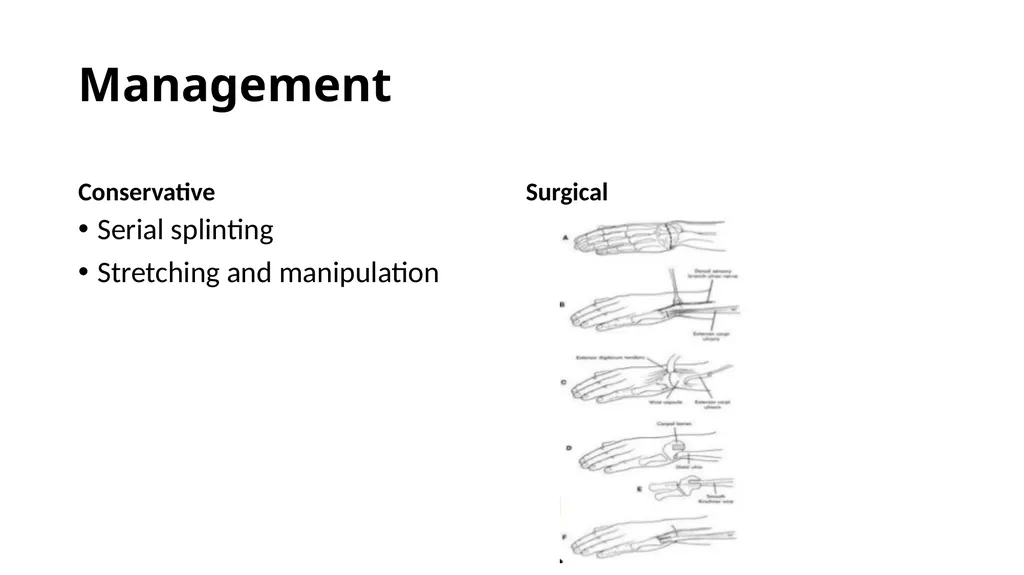Congenital Hand Abnormalities Nick Sheppard AO AF - slide 12 of 26