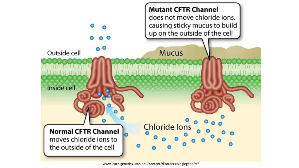 Nutrition and Cystic Fibrosis Module 1: Cystic - slide 4 of 20