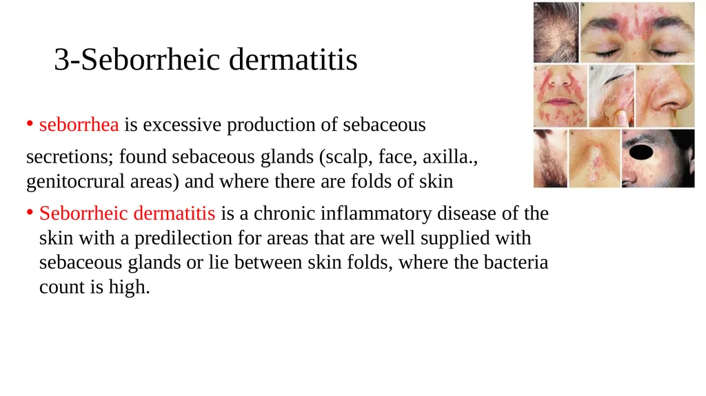 Skin disorder Dermatitis Assistant lecturers Sadiq - slide 8 of 17