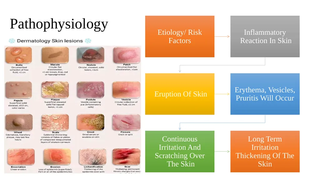 Skin disorder Dermatitis Assistant lecturers Sadiq - slide 3 of 17
