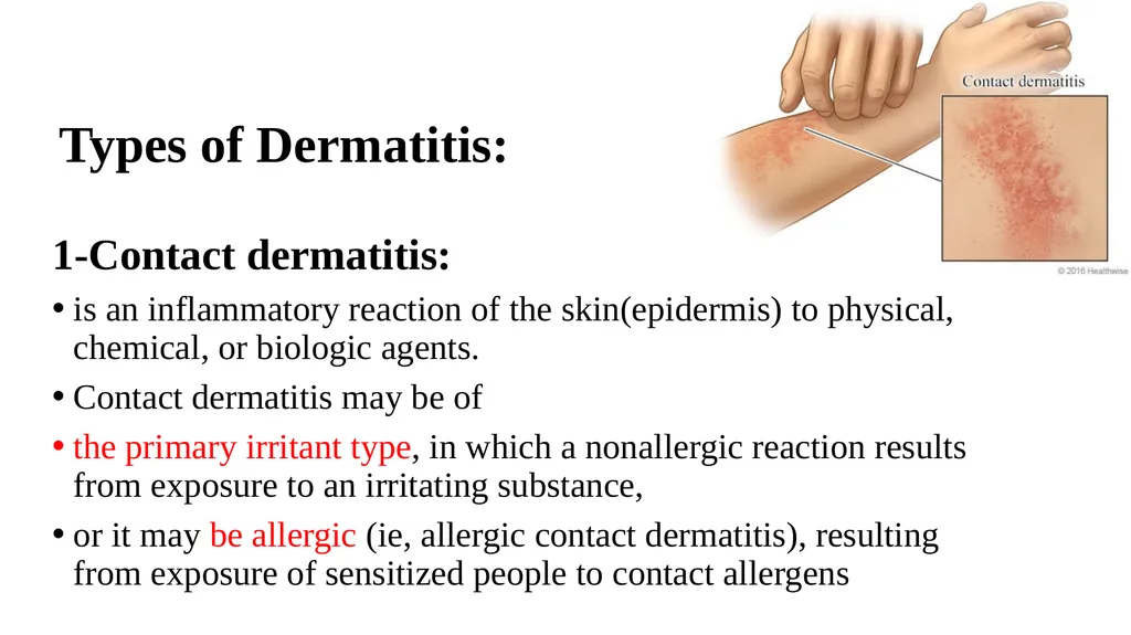 Skin disorder Dermatitis Assistant lecturers Sadiq - slide 4 of 17