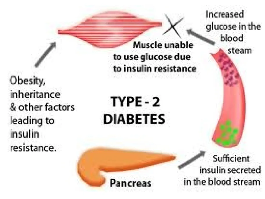 DIABETES MELLITUS Greek- Diabetes-siphon, - slide 64 of 108