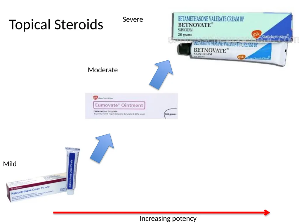 Atopic Eczema in children Dr C Macaulay Dr C Lemer - slide 10 of 15