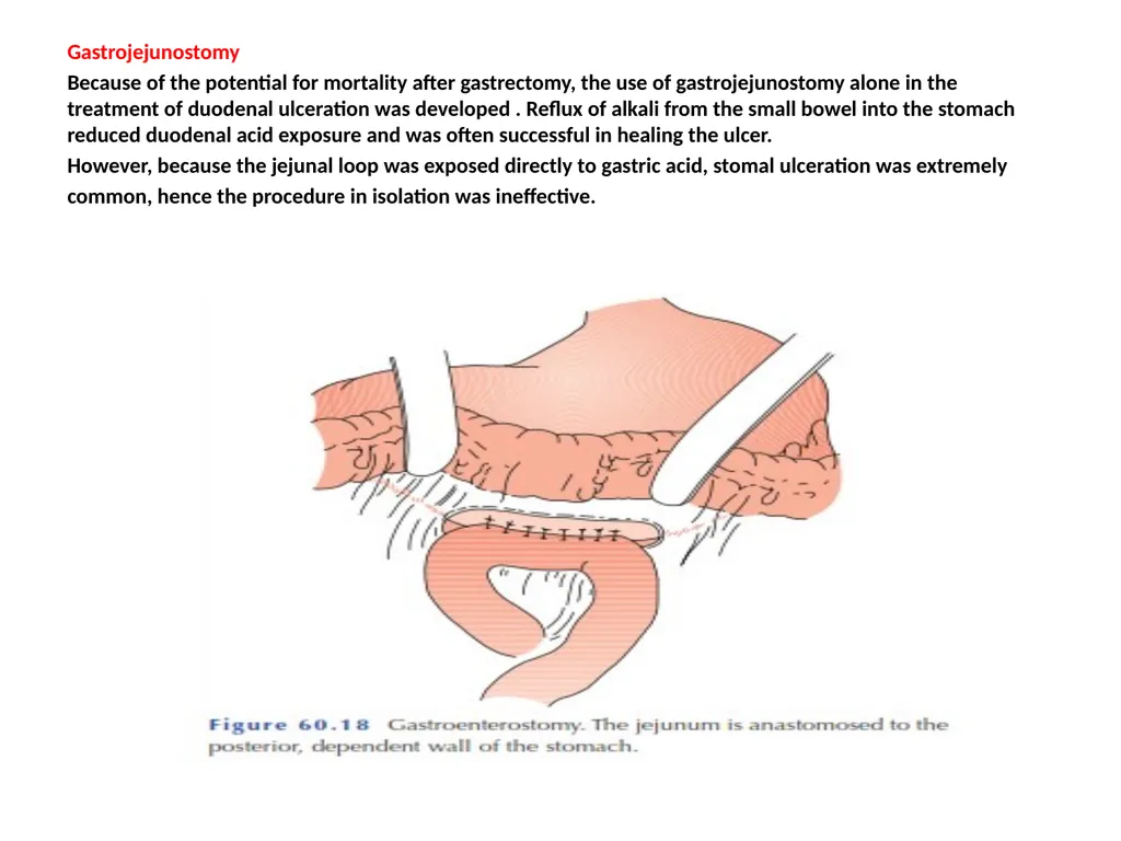 اعداد الدكتور زيد علي مجيد جراح اختصاص Lec. 2 - slide 11 of 17