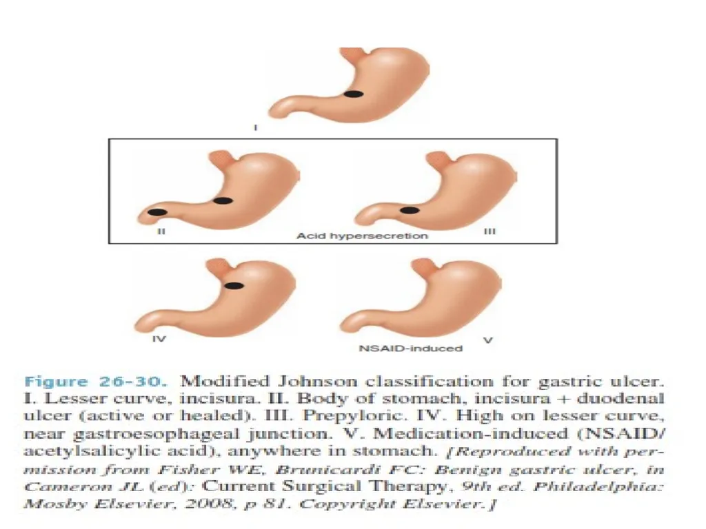 اعداد الدكتور زيد علي مجيد جراح اختصاص Lec. 2 - slide 7 of 17