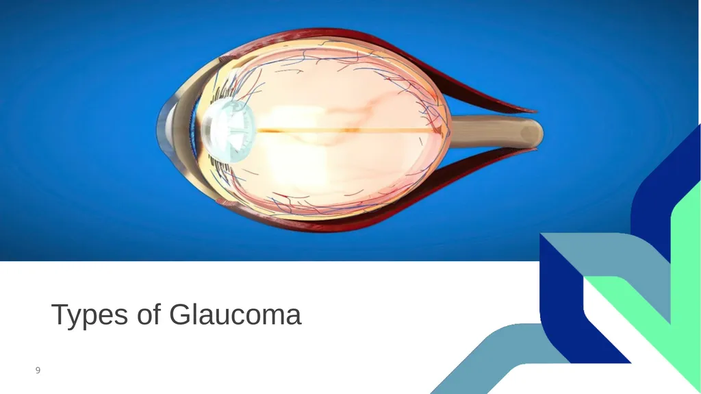 Glaucoma Screening (Clinical) February 2026 - slide 9 of 31