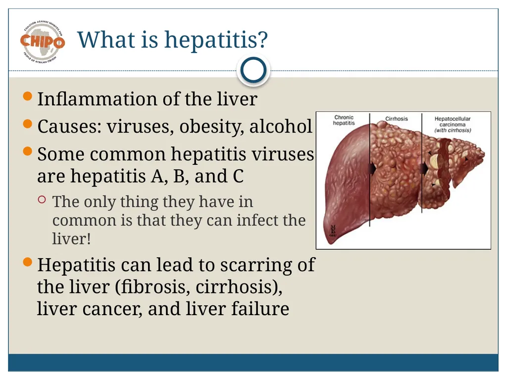 An Educational Resource Hepatitis B in People of - slide 7 of 23