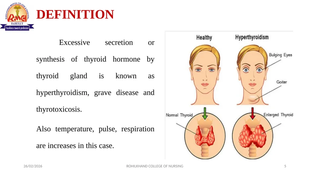 HYPERTHYROIDISM MR. DINESH SINGH P.G. NURSING - slide 5 of 15