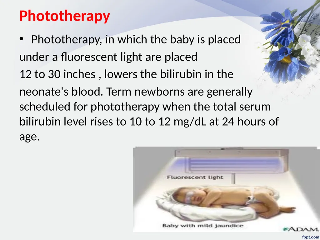 Jaundice (Hyperbilirubinemia) Lecturer Assistant - slide 15 of 16