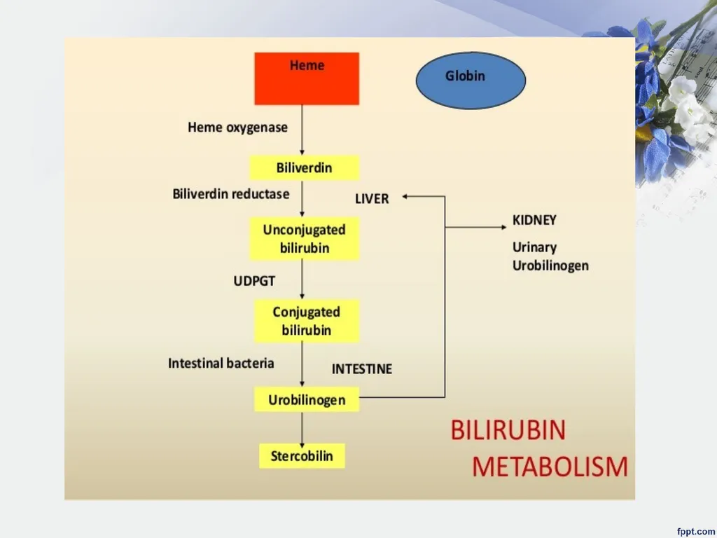 Jaundice (Hyperbilirubinemia) Lecturer Assistant - slide 6 of 16