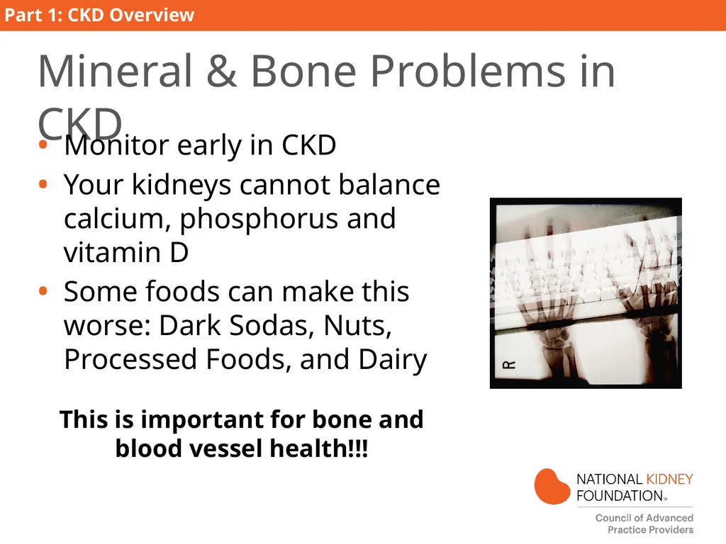 Kidney Disease Education PART 1: CKD Overview - slide 20 of 27