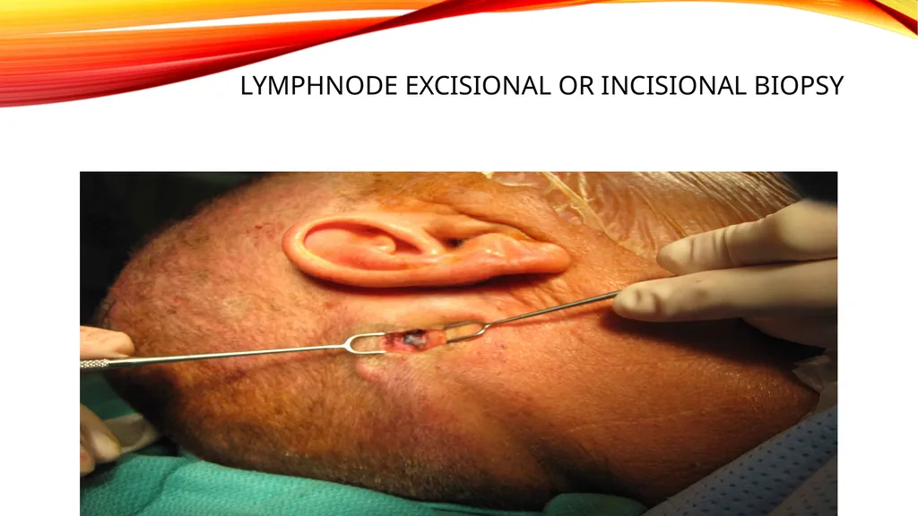 LYMPHOMA & LEUKEMIA a closer look SEER - slide 20 of 37