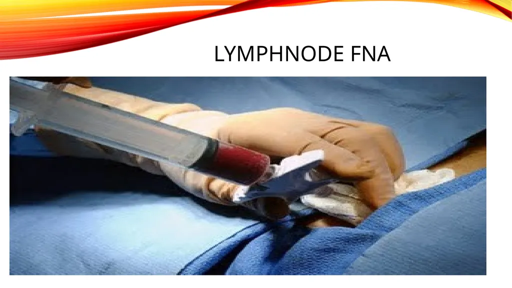 LYMPHOMA & LEUKEMIA a closer look SEER - slide 21 of 37