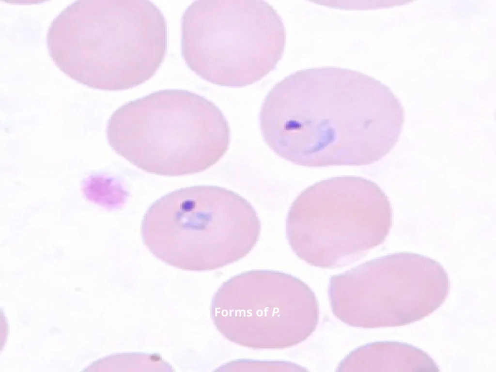 MALARIA By TARIK ZAHER Assistant Professor of - slide 9 of 46