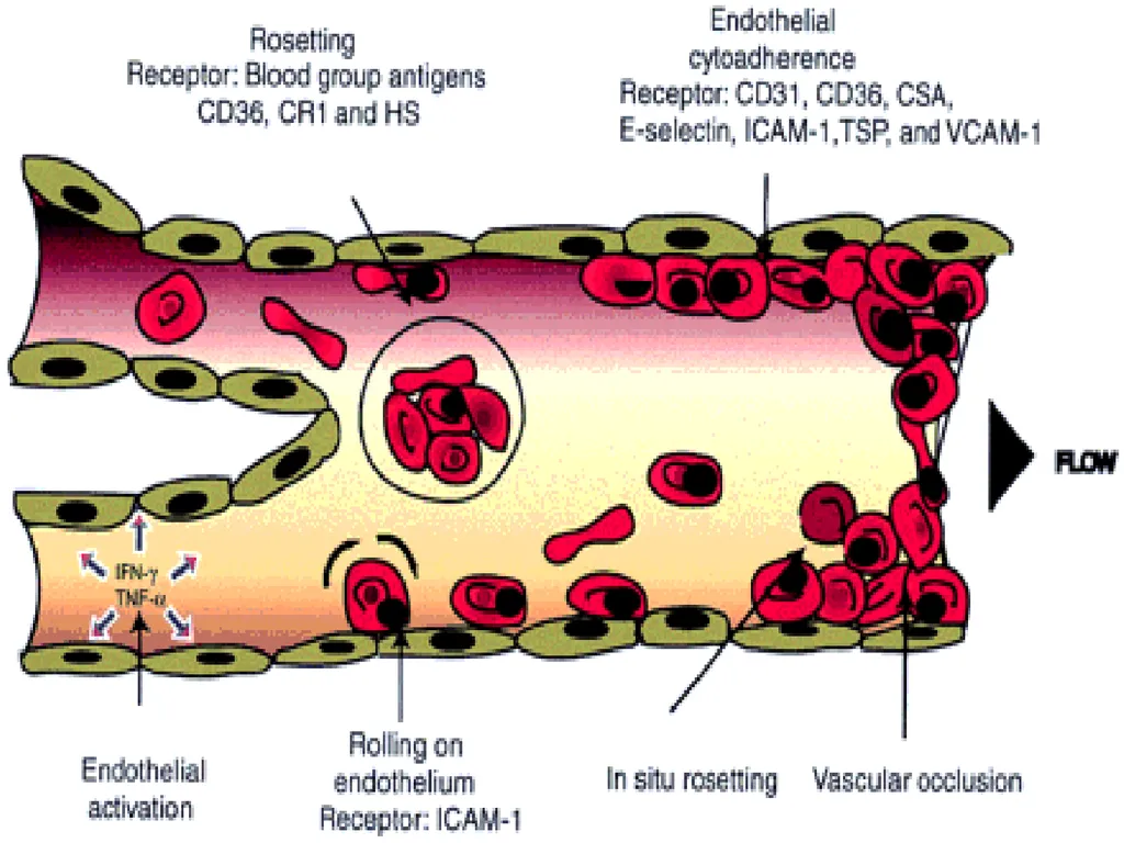 MALARIA By TARIK ZAHER Assistant Professor of - slide 17 of 46