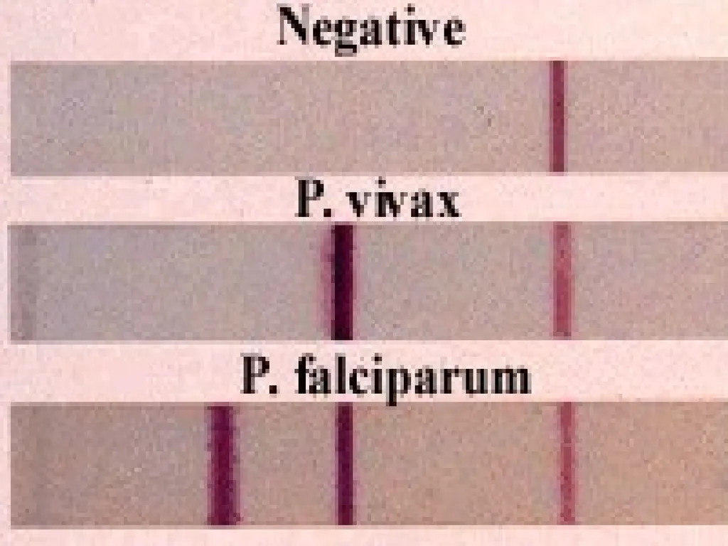 MALARIA By TARIK ZAHER Assistant Professor of - slide 32 of 46