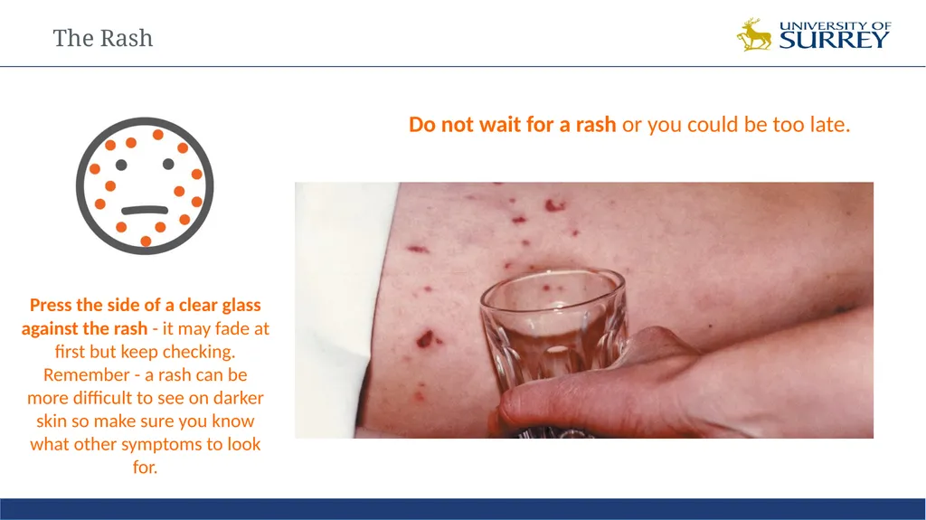 Meningitis Awareness Training Laura Smythson - slide 8 of 10