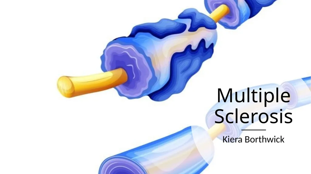 Multiple Sclerosis Kiera Borthwick “What does MS - slide 1 of 12
