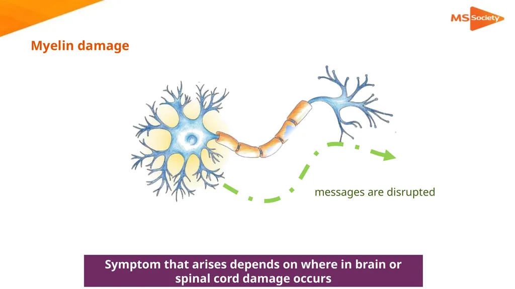 A palliative approach to multiple sclerosis: - slide 10 of 69
