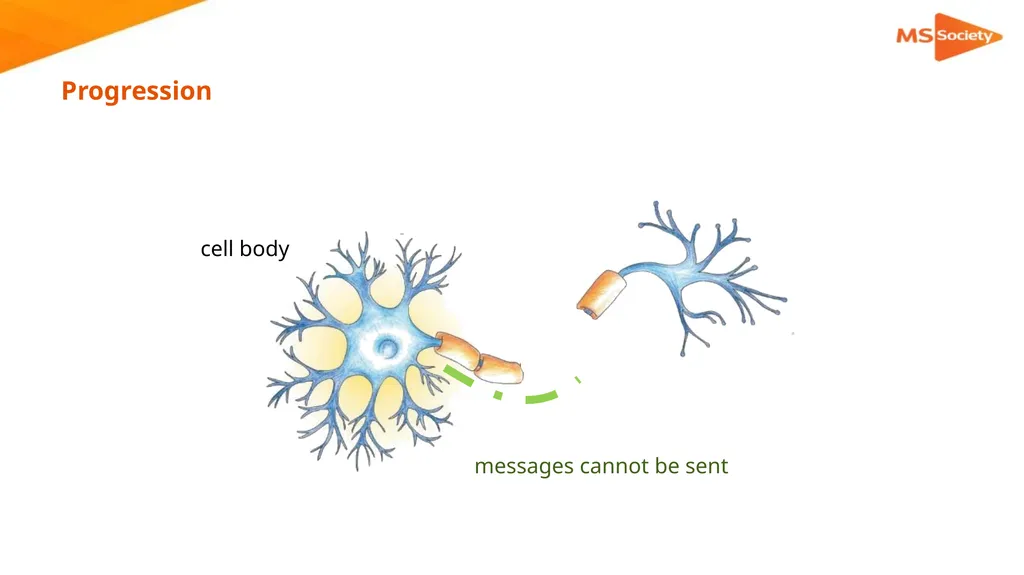 A palliative approach to multiple sclerosis: - slide 11 of 69