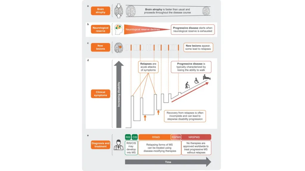 A palliative approach to multiple sclerosis: - slide 61 of 69