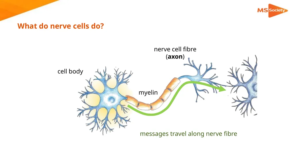 A palliative approach to multiple sclerosis: - slide 8 of 69