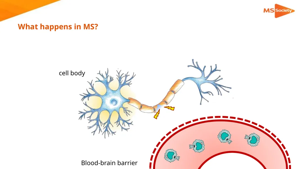 A palliative approach to multiple sclerosis: - slide 9 of 69