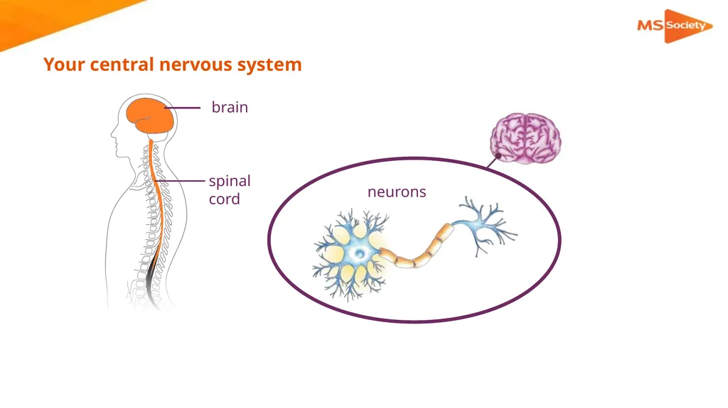 A palliative approach to multiple sclerosis: - slide 7 of 69
