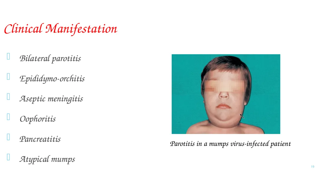 PARAMYXOVIRIDAE INFECTIONS 1 PARAMYXOVIRIDAE - slide 19 of 51