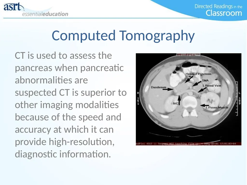 Clinical Signs and Characteristics of Pancreatitis - slide 9 of 17