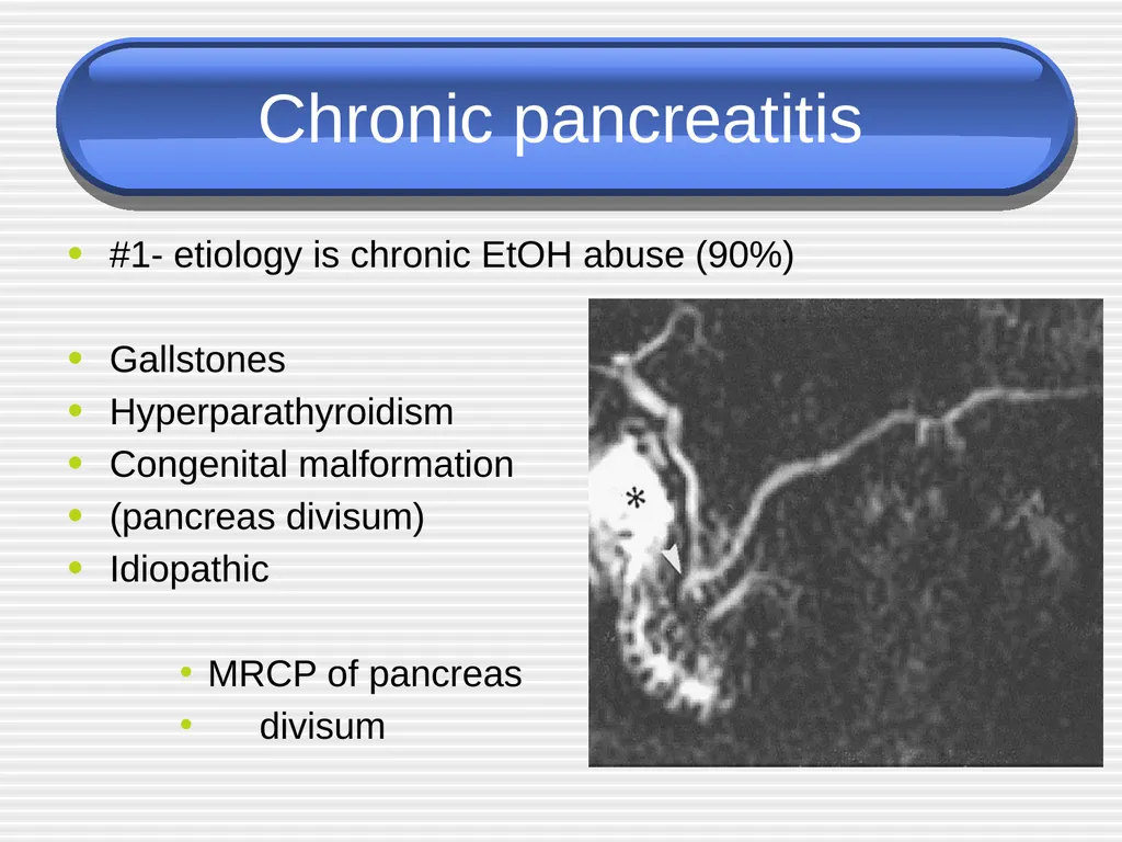 Acute pancreatitis defined as an acute condition - slide 28 of 36