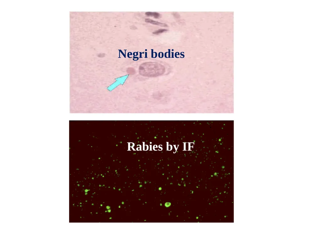 Rabies Hydrophobia, lyssa or lytta By Dr/ Marawan - slide 19 of 22