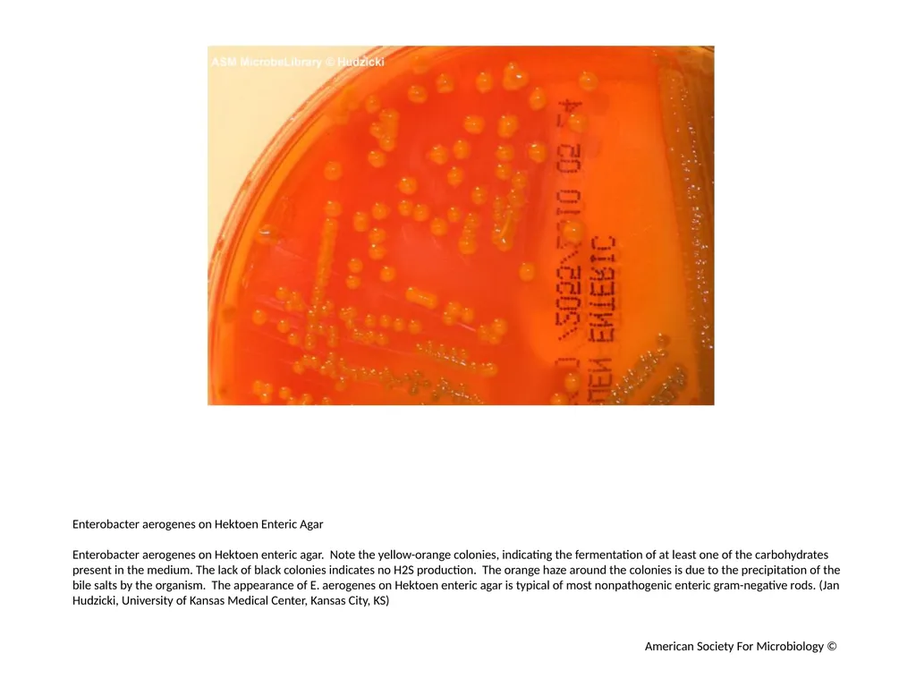 Hektoen Enteric Agar Author: Multiple Authors - slide 4 of 11